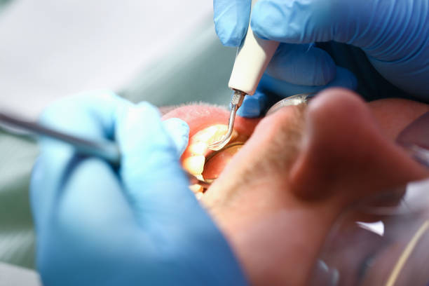 Best Orthodontic Emergency Dentist in Wellsville, KS